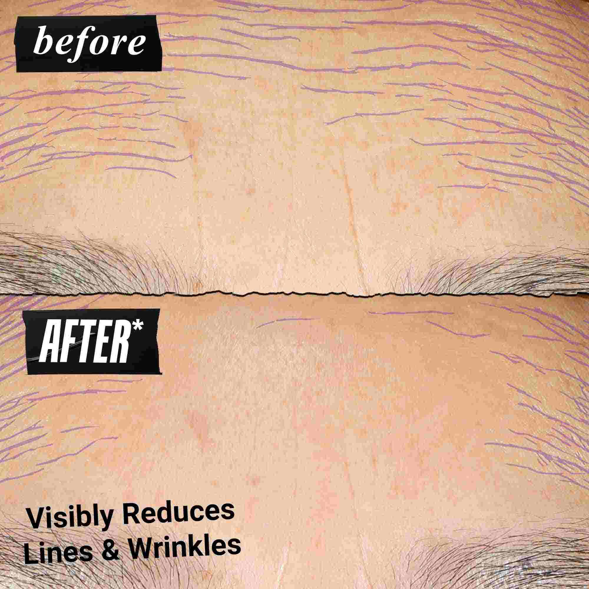 Fotografija Prije i Poslije – Kiehl's Retinol Skin Renewing Daily Microdose pomaže u poboljšanju tona i teksture kože