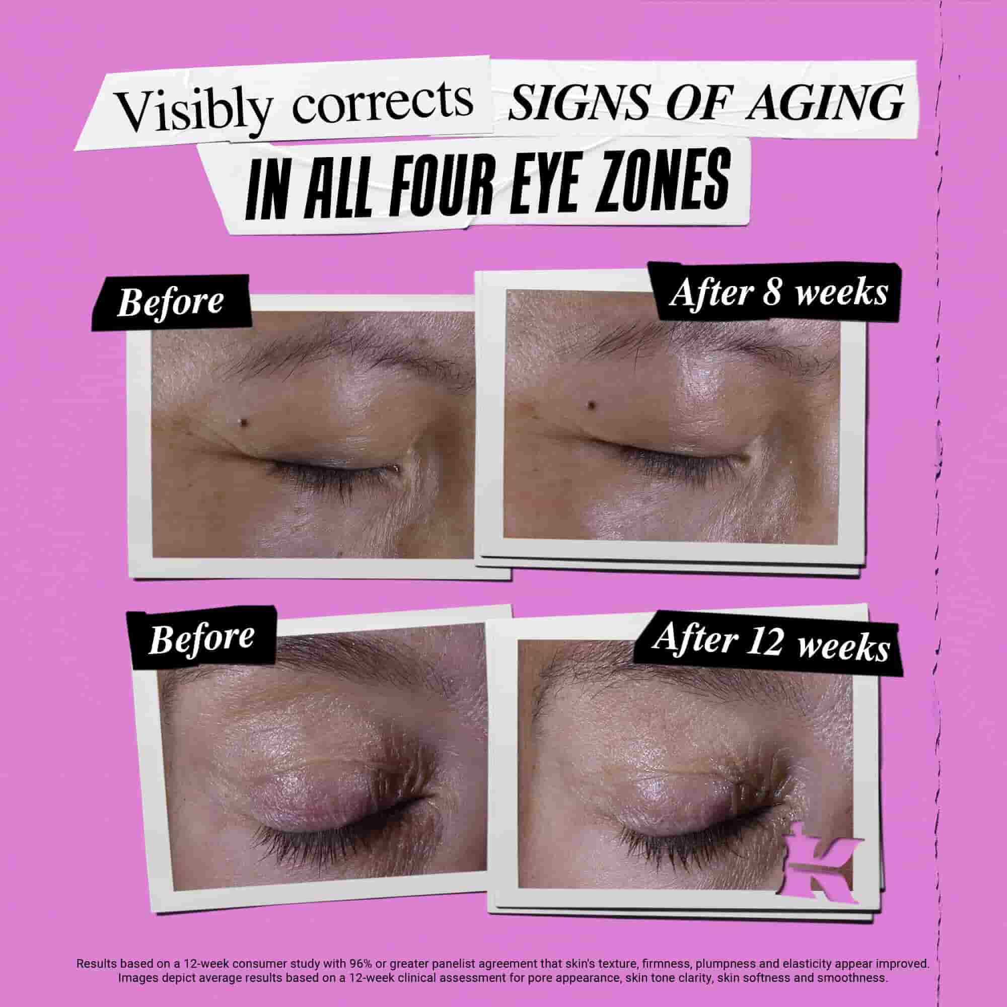 Fotografija Prije i Poslije – Kiehl's Super Multi-Corrective Eye Zone Treatment korigira znakove starenja