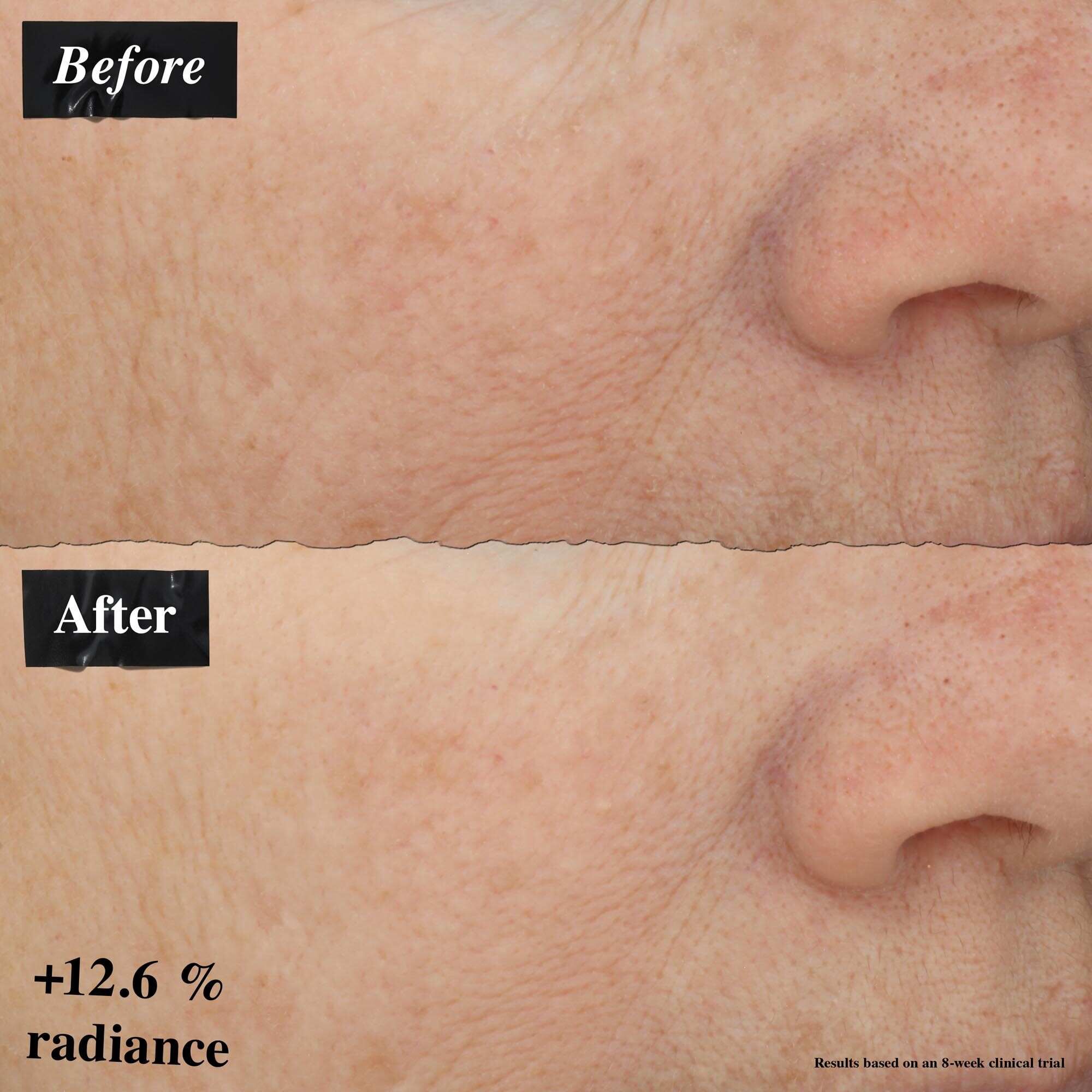 Usporedba slika prije i poslije koja prikazuje poboljšanje crvenila kože nakon korištenja Powerful-Strength Line-Reducing Concentrate.