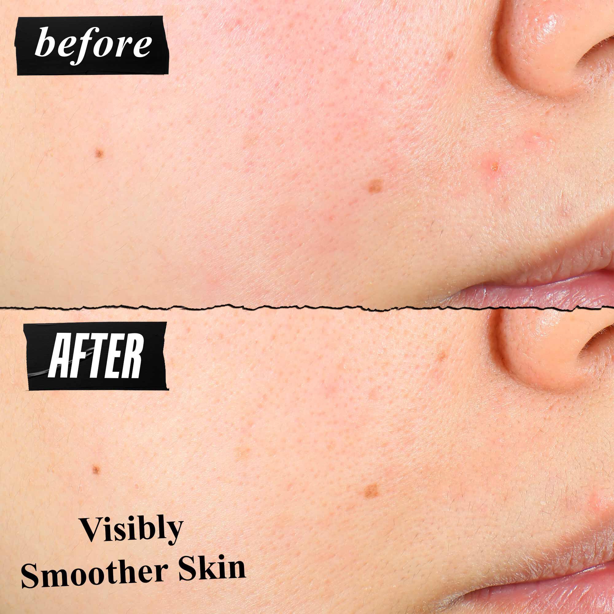 Usporedba teksture kože prije i poslije koja pokazuje vidljivo glađu kožu nakon korištenja.