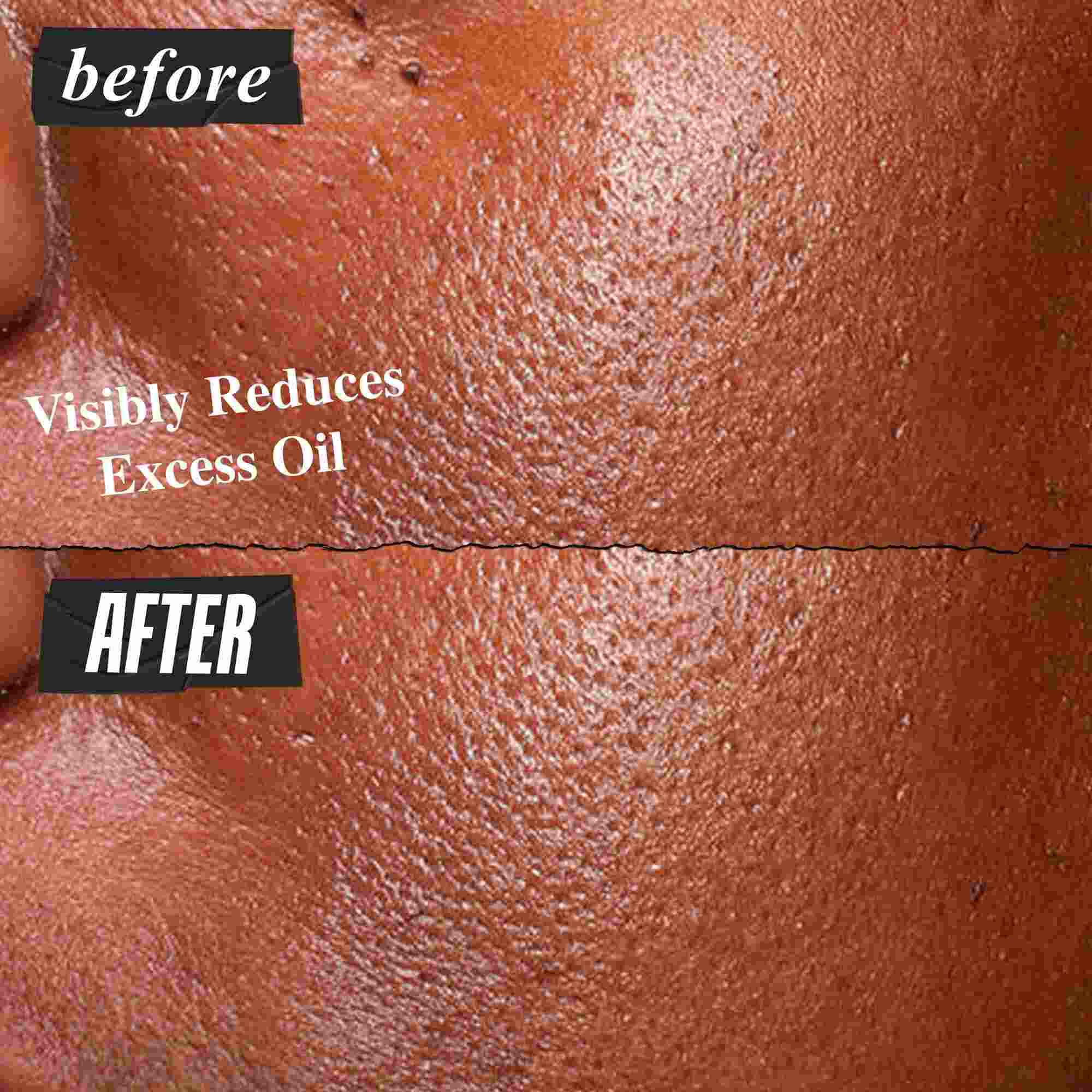 Fotografija Prije и Poslije – Kiehl's Ultra Pure serum vidljivo smanjuje višak masnoće