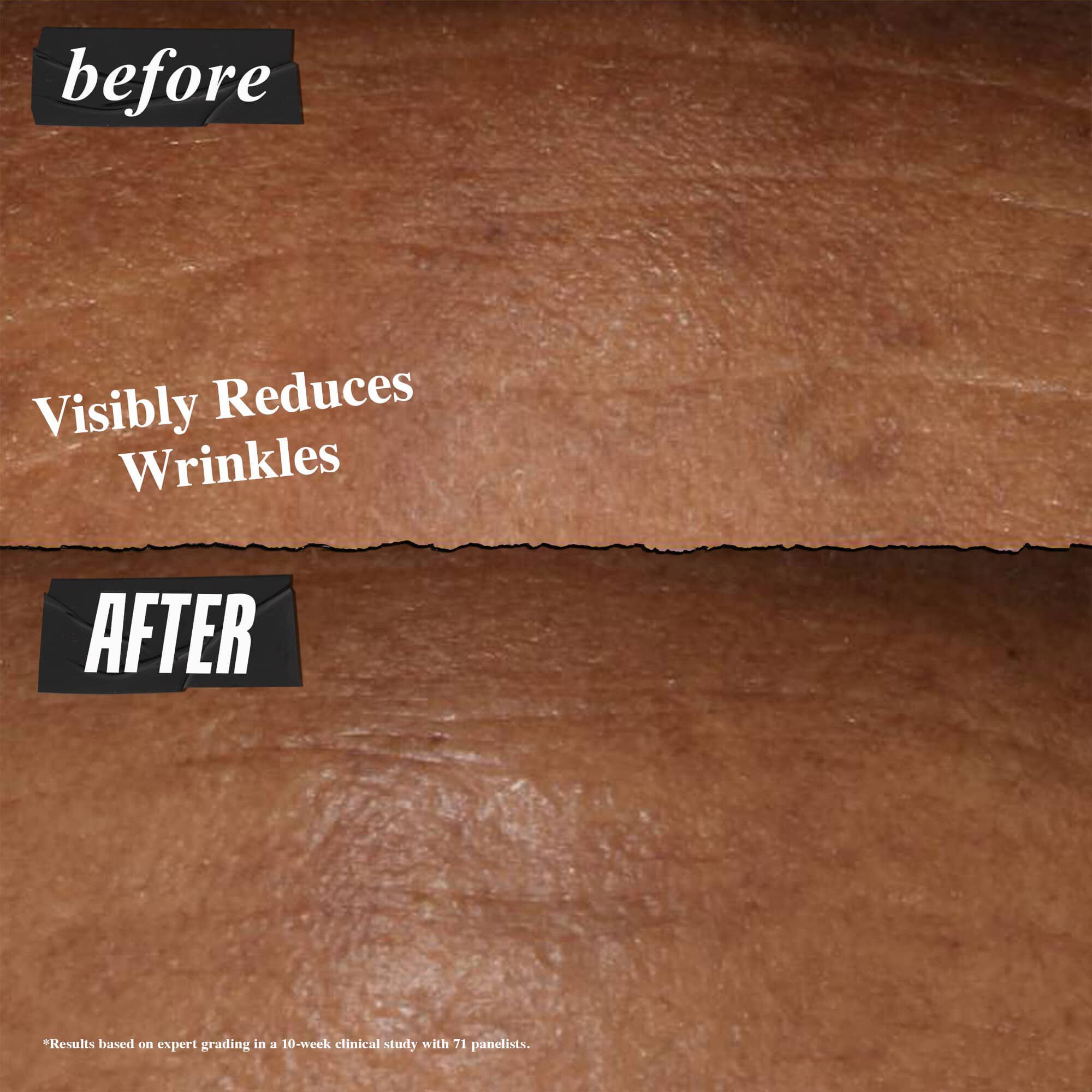 Fotografija Prije i Poslije – noćni serum Kiehl's Retinol Fast Release vidljivo smanjuje bore