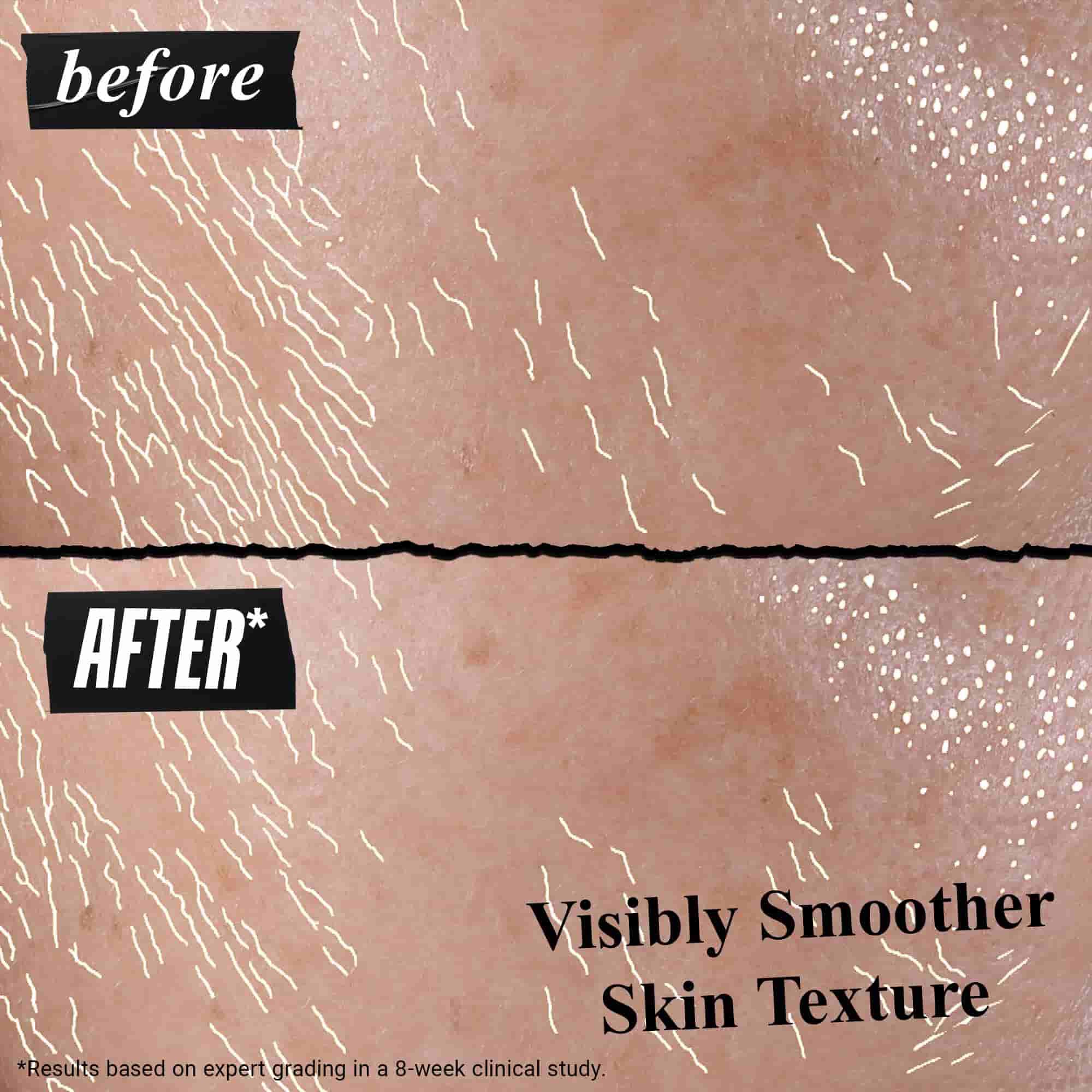 Rezultati na koži prije i poslije Better Screen UV Serum