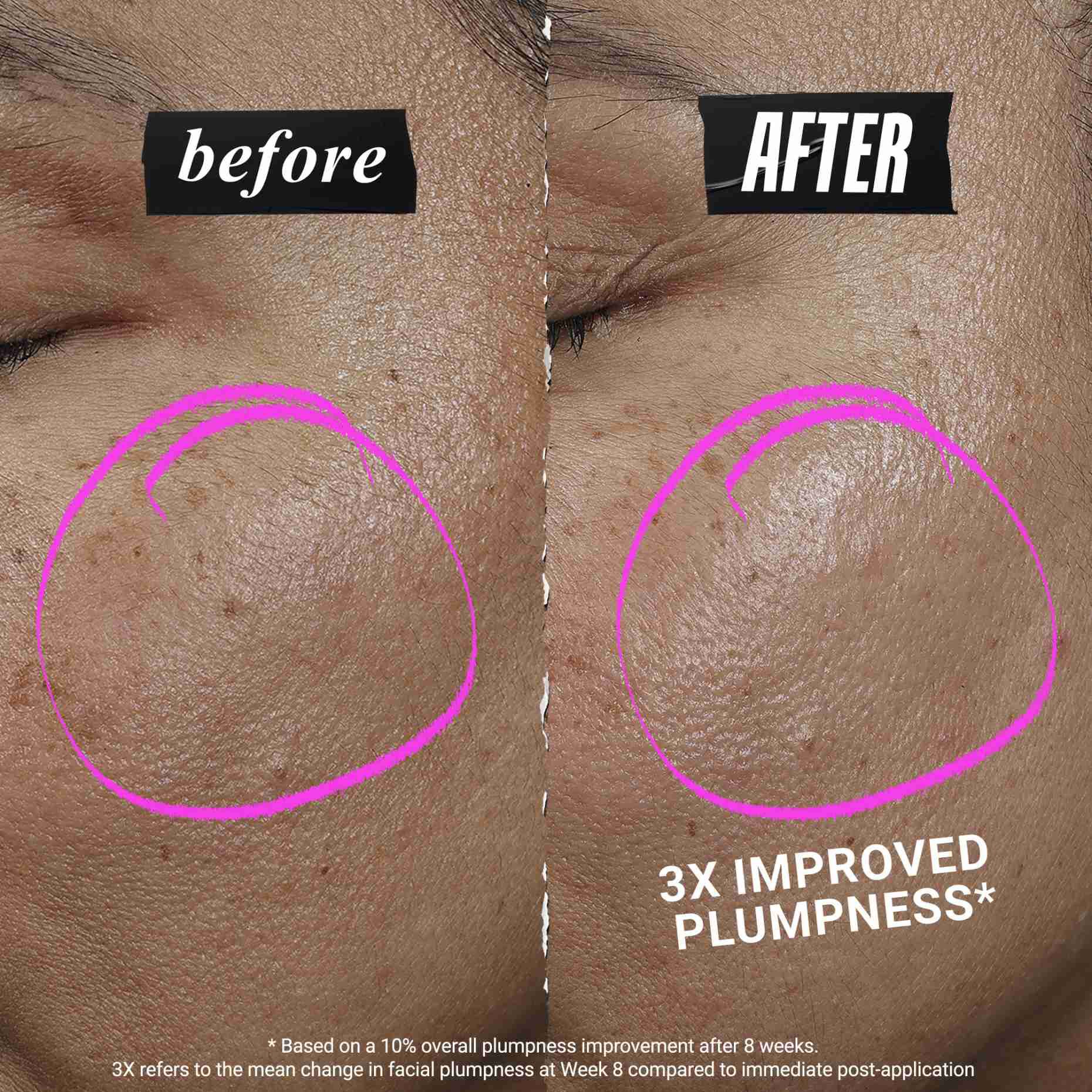 1cc* CollaShot Plump serum, serum za lice s rekombinantnim kolagenom za učvrsnuti i puniji izgled kože