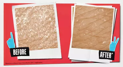 Two photo frames side by side on a red background. The left frame labeled "Before" shows a textured skin surface with fine lines, while the right frame labeled "After" displays a smoother skin surface with fewer visible lines.