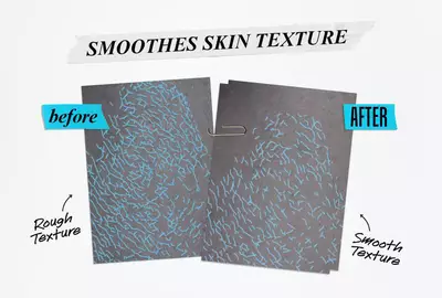 A comparison image showing two paper sheets side by side: the left labeled "before" with a rough texture design in blue, and the right labeled "after" with a smooth texture design in blue, illustrating improvement in skin texture.